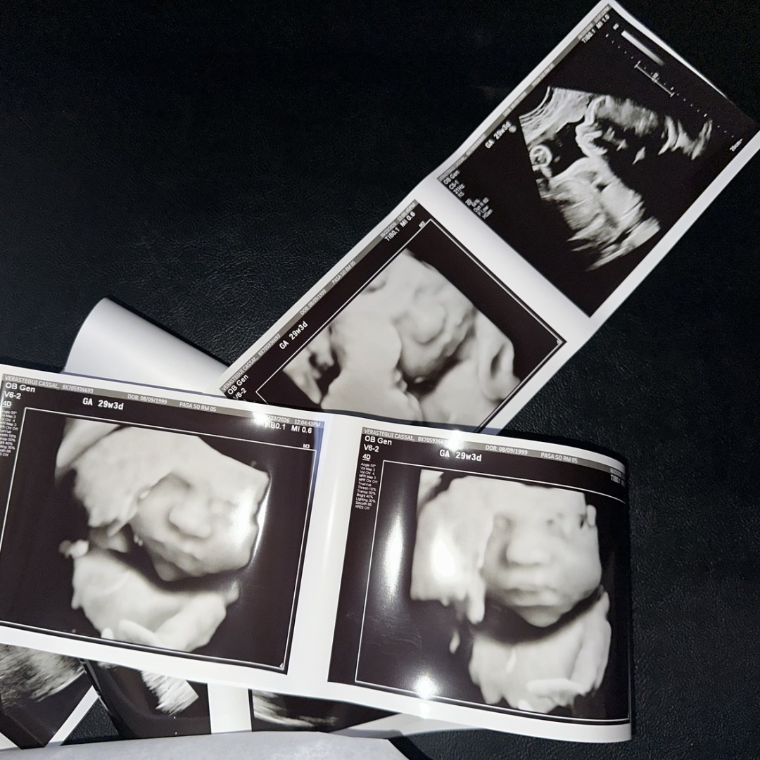 Photo shared by Cassandra for their Babylist baby registry.