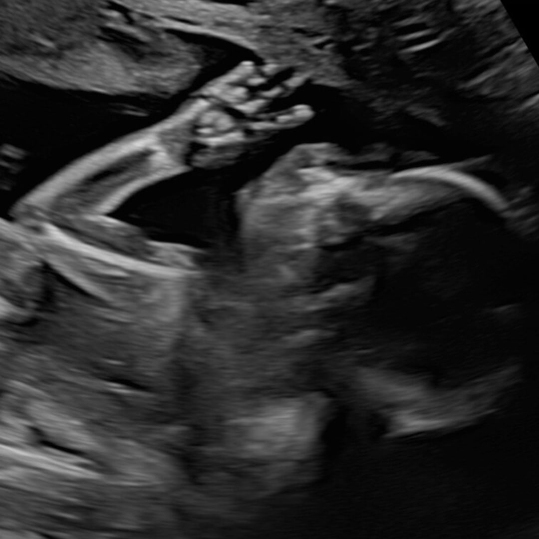 Photo shared by Cecilia for their Babylist baby registry.