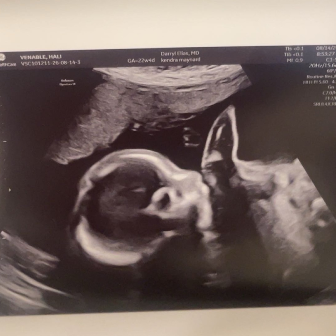 Photo shared by Hali for their Babylist baby registry.