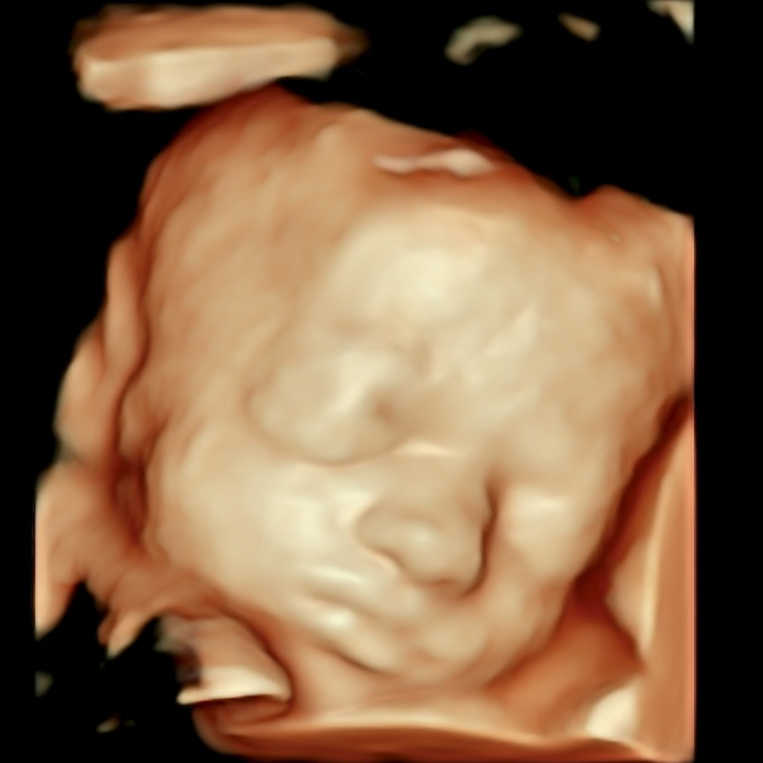 Photo shared by Samantha for their Babylist baby registry.