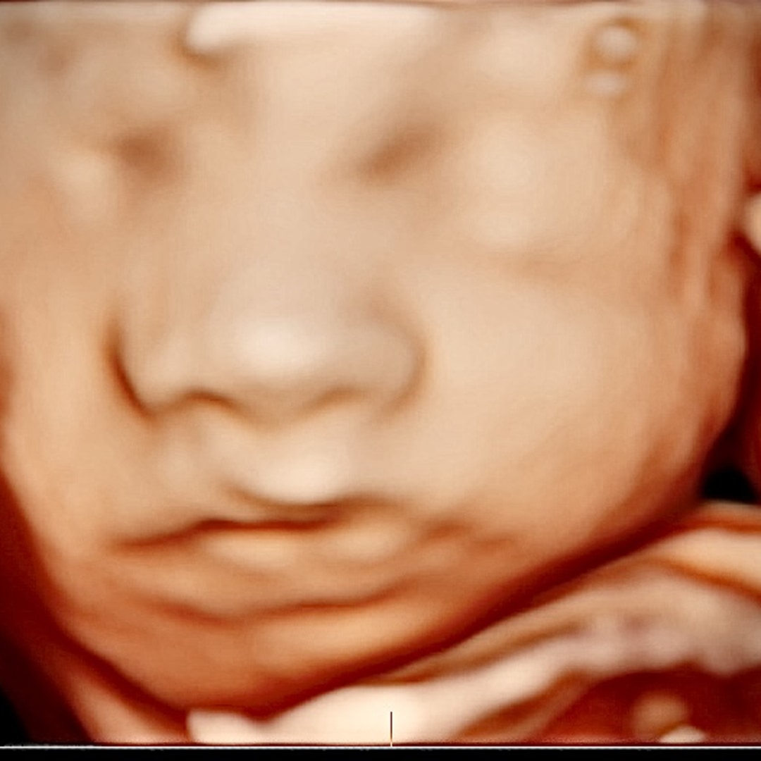 Photo shared by Casey for their Babylist baby registry.