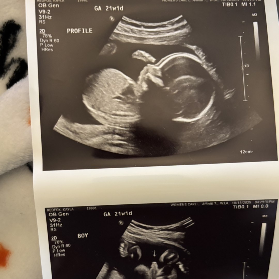 Photo shared by Kayla for their Babylist baby registry.