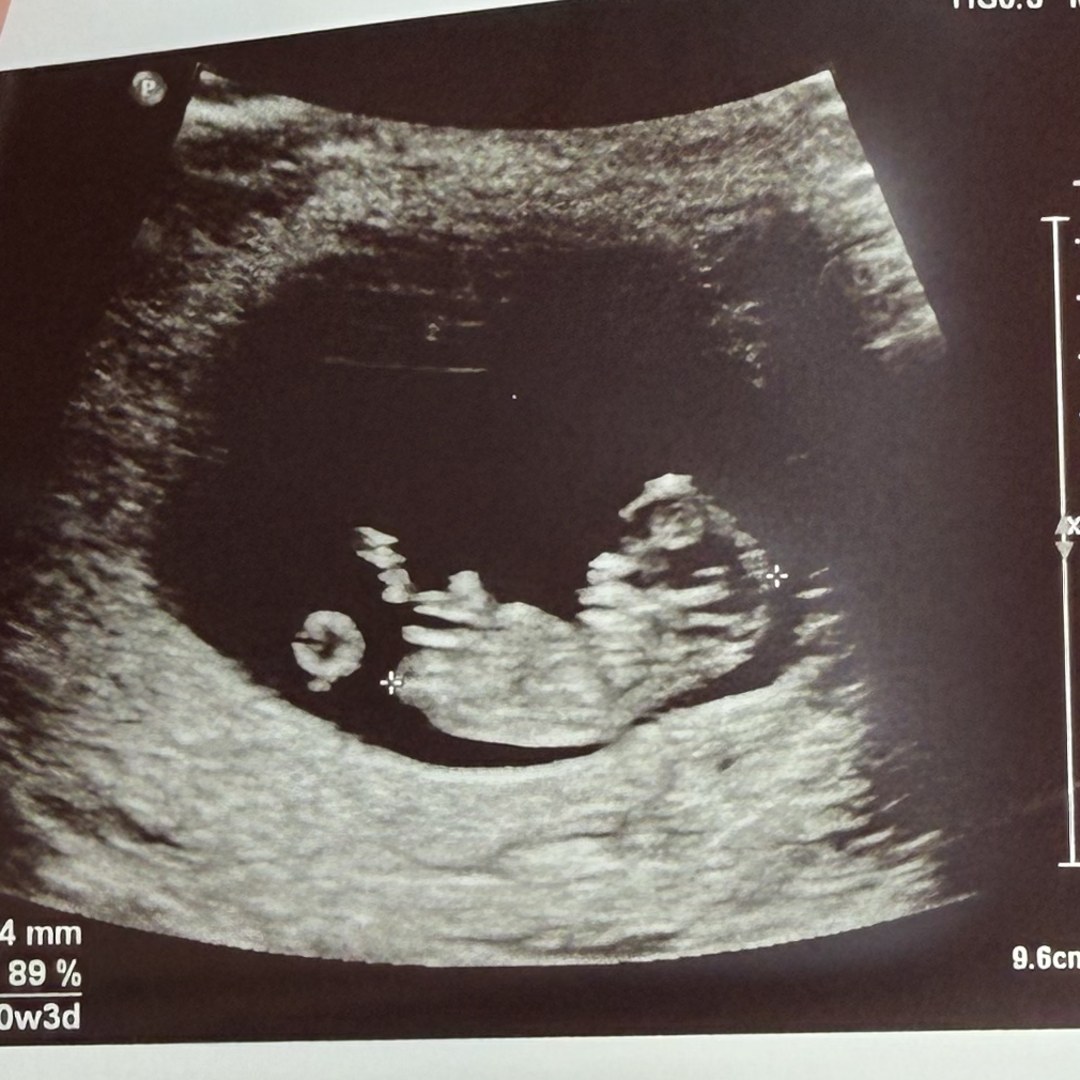 Photo shared by Chloe for their Babylist baby registry.