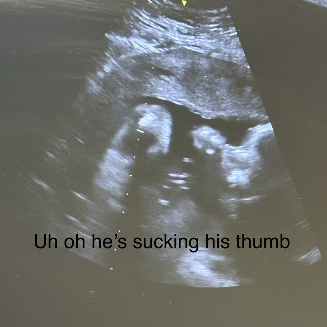 Photo shared by Hailey for their Babylist baby registry.
