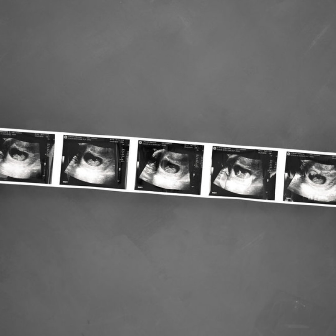 Photo shared by Hannah for their Babylist baby registry.