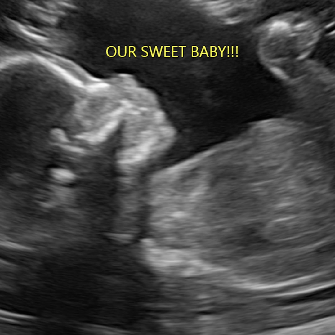 Photo shared by Kelly for their Babylist baby registry.