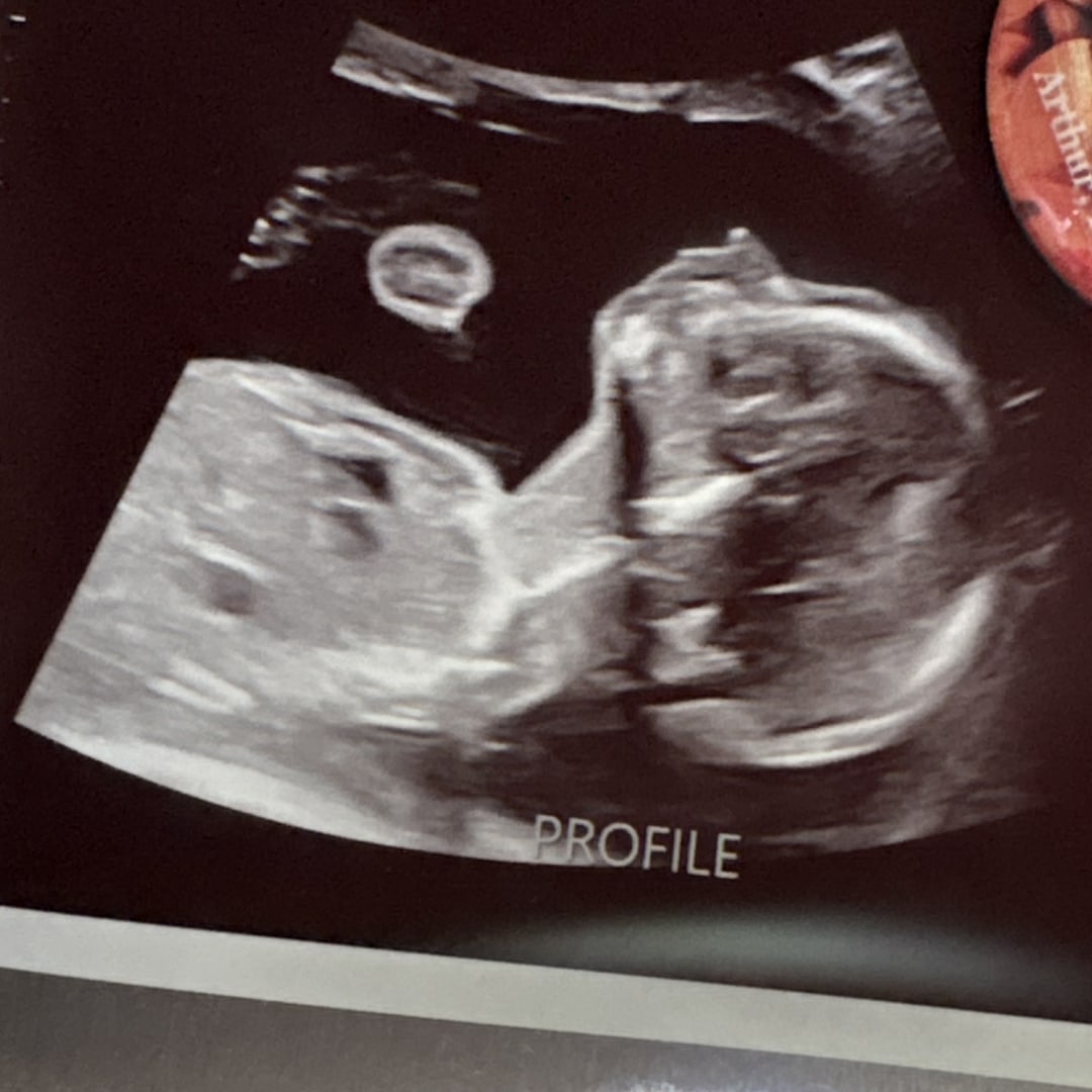Photo shared by Clara for their Babylist baby registry.
