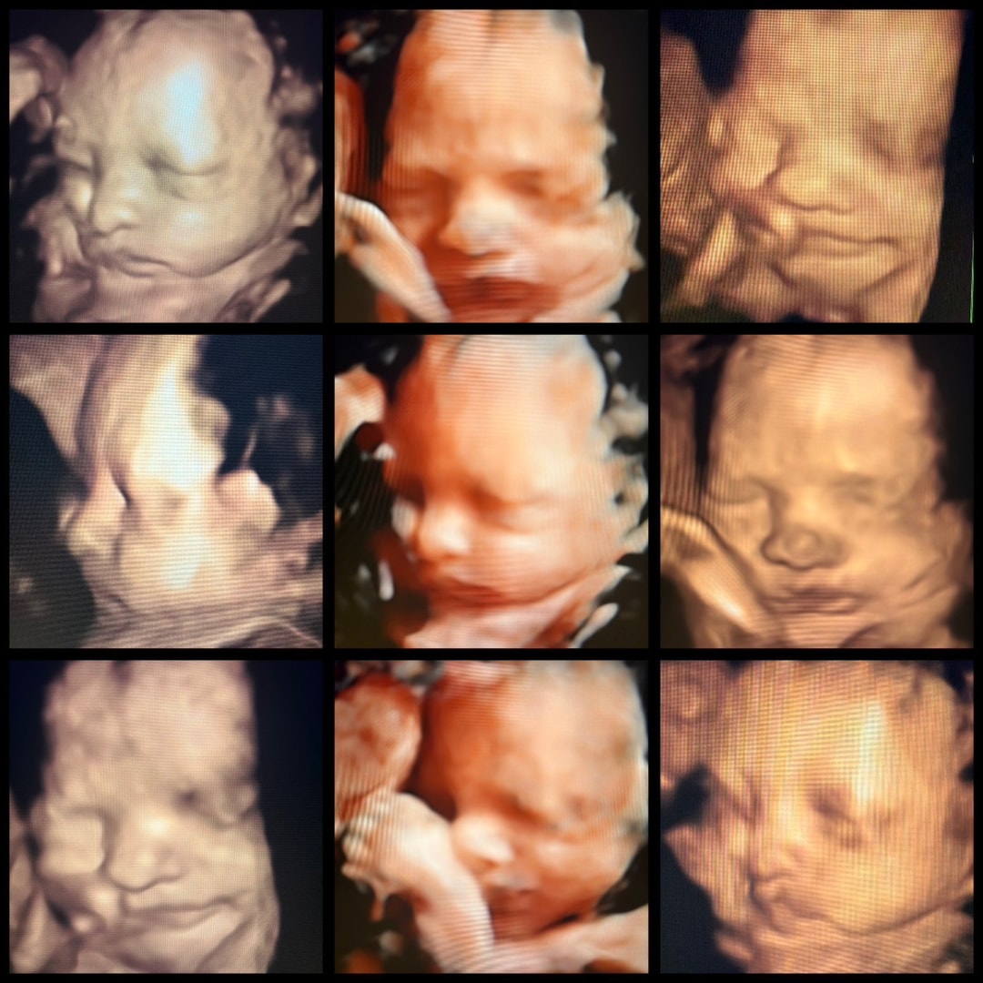 Photo shared by Abigail for their Babylist baby registry.
