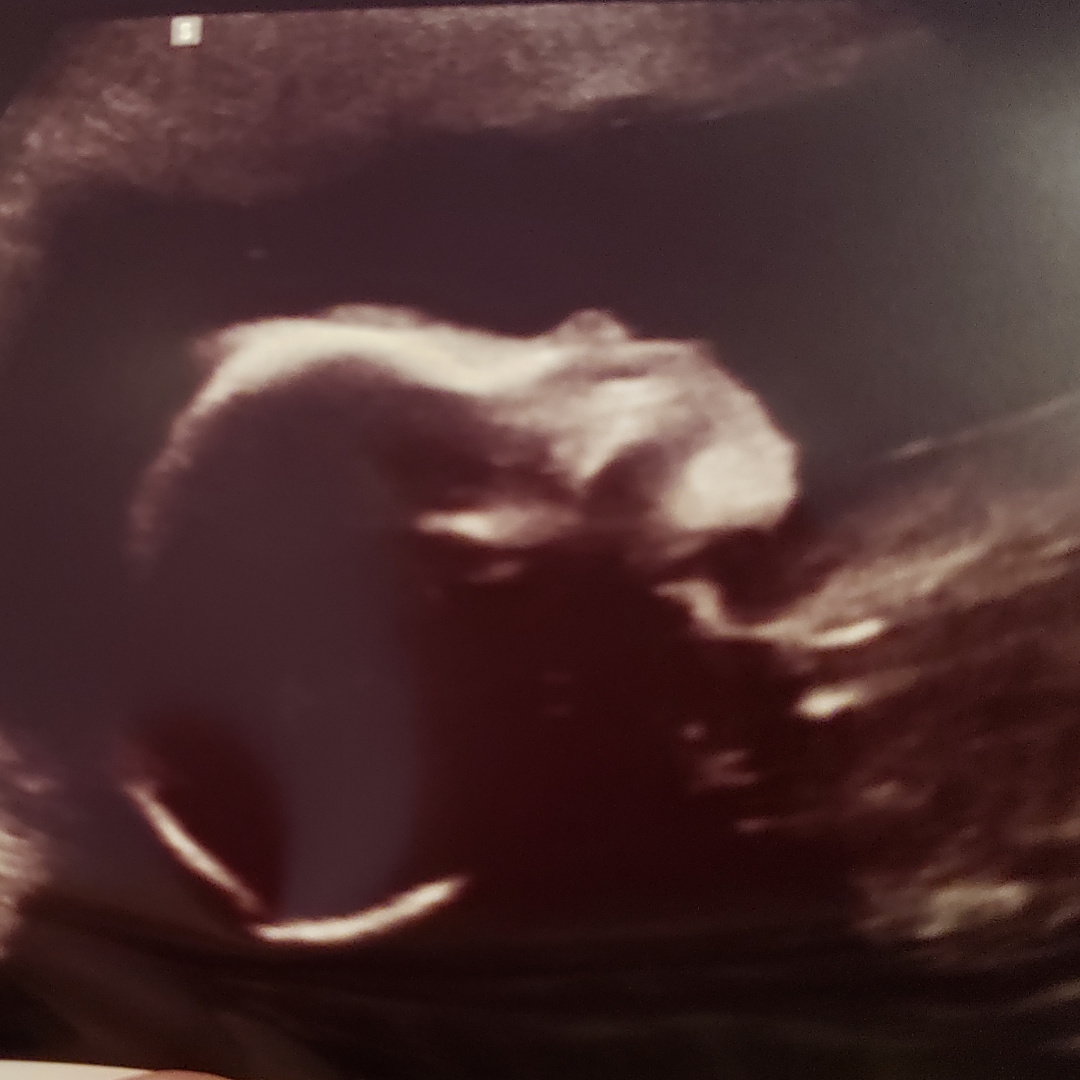 Photo shared by Valerie for their Babylist baby registry.