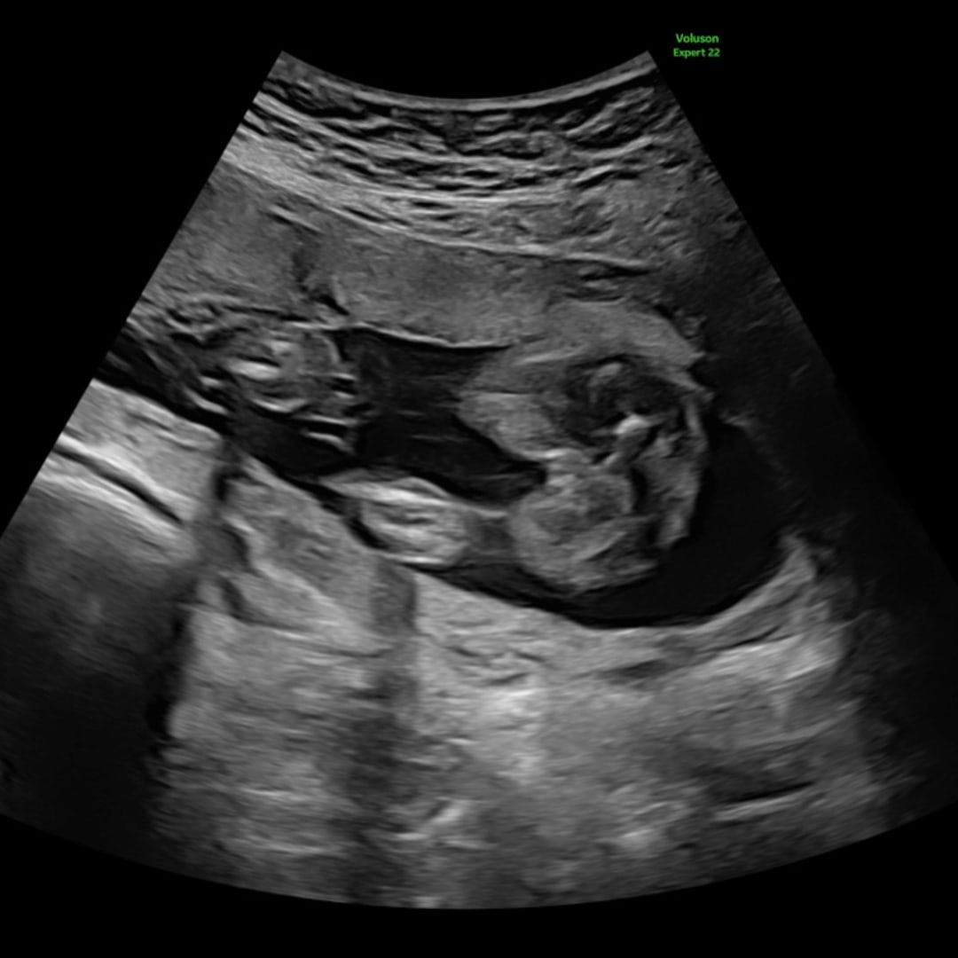 Photo shared by Cortney for their Babylist baby registry.