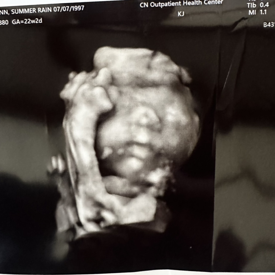 Photo shared by Summer for their Babylist baby registry.