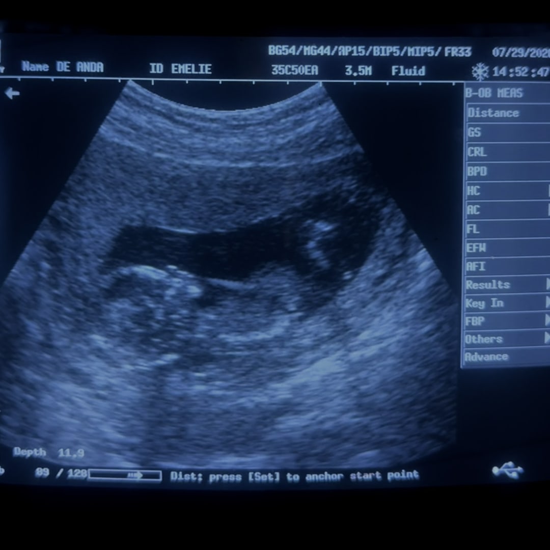 Photo shared by Emelie for their Babylist baby registry.