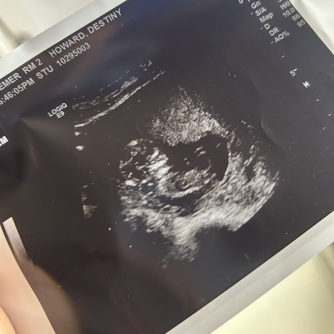 Photo shared by Destiny for their Babylist baby registry.