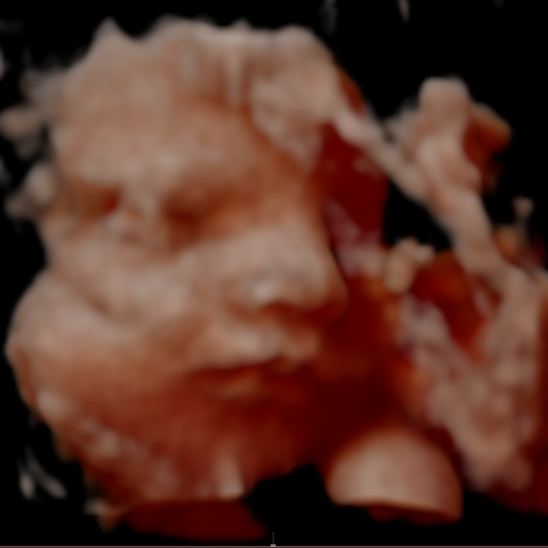 Photo shared by Sam for their Babylist baby registry.