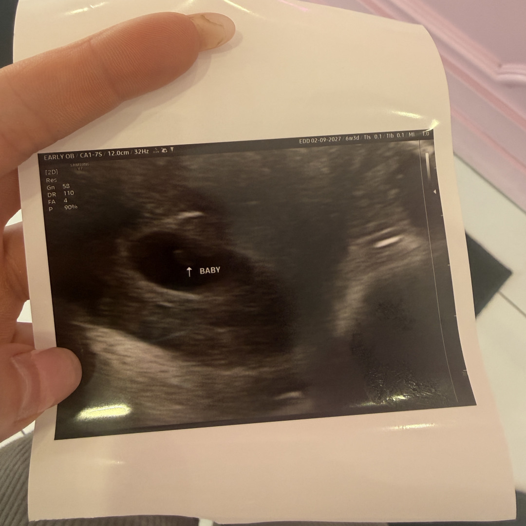 Photo shared by Anna for their Babylist baby registry.