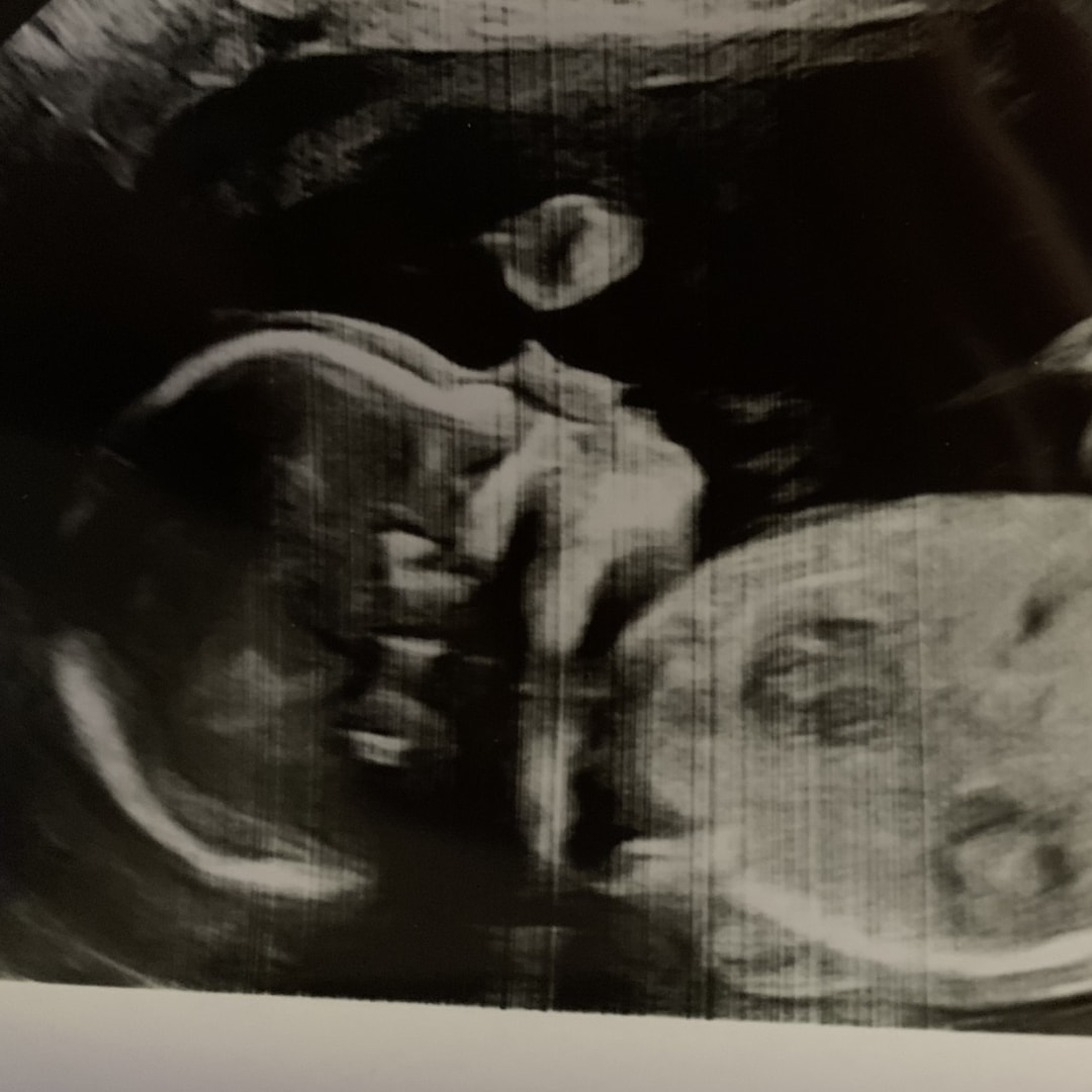 Photo shared by Nicolette for their Babylist baby registry.