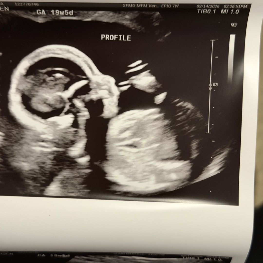 Photo shared by Aleina for their Babylist baby registry.