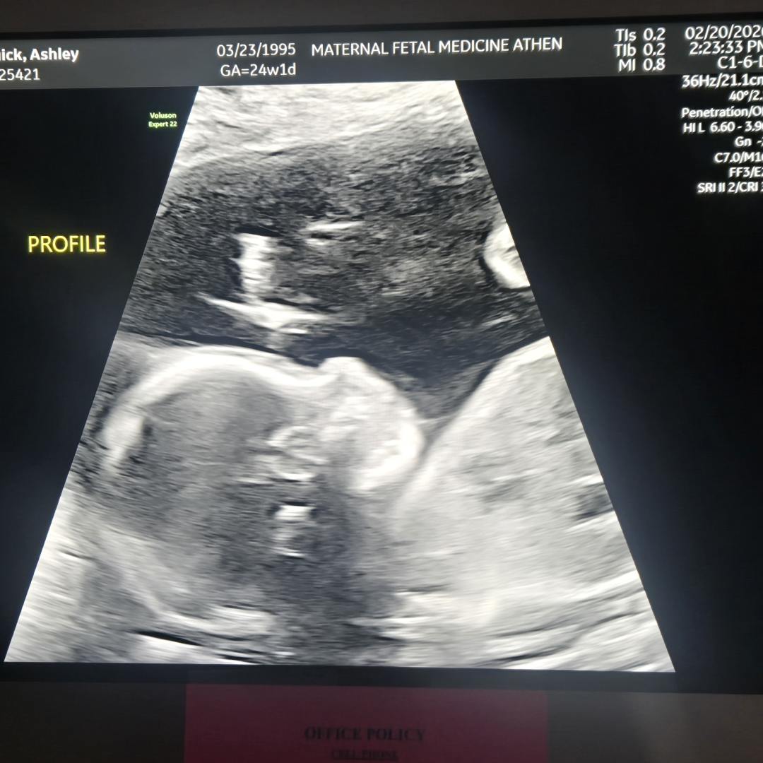Photo shared by Ashley for their Babylist baby registry.
