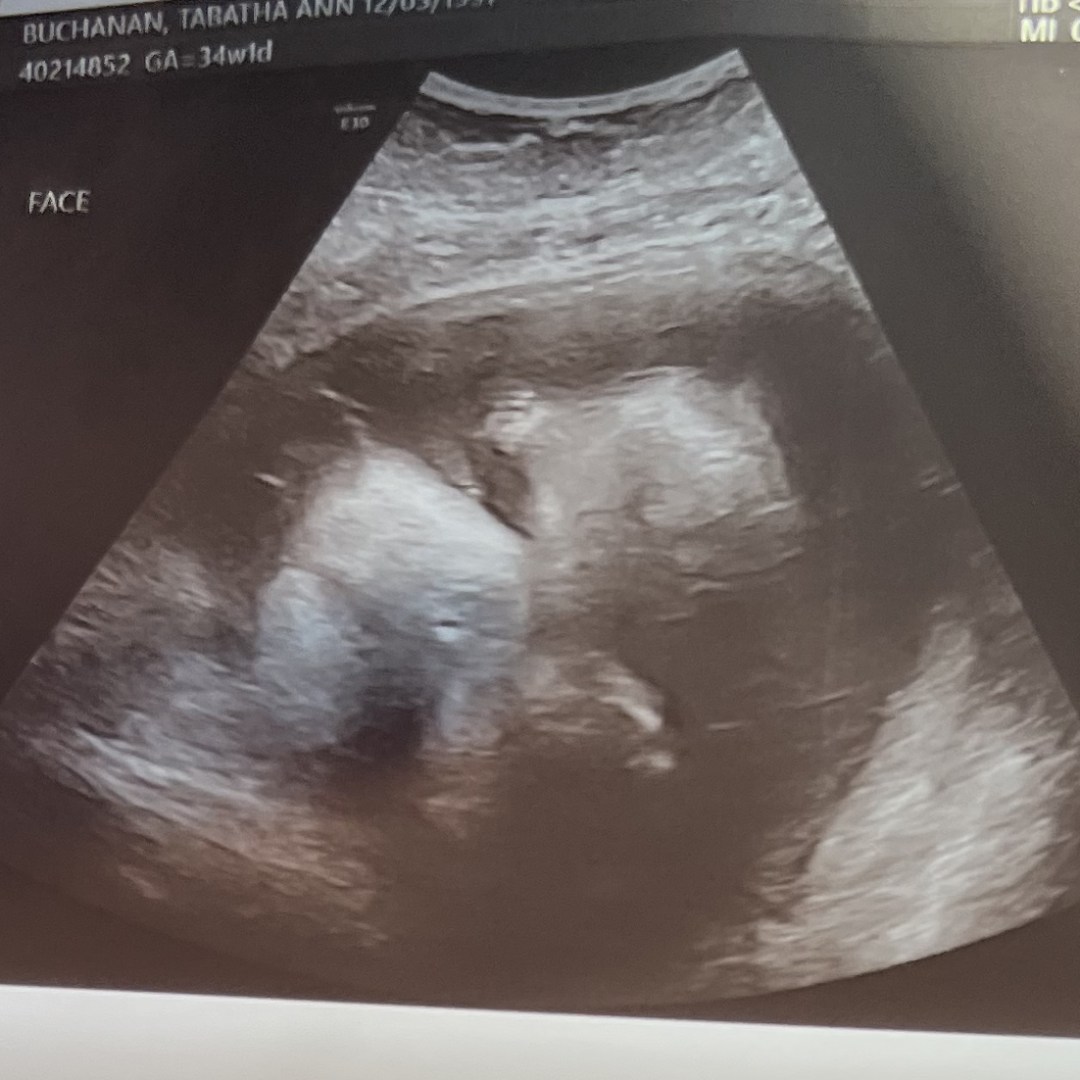 Photo shared by Tabatha for their Babylist baby registry.