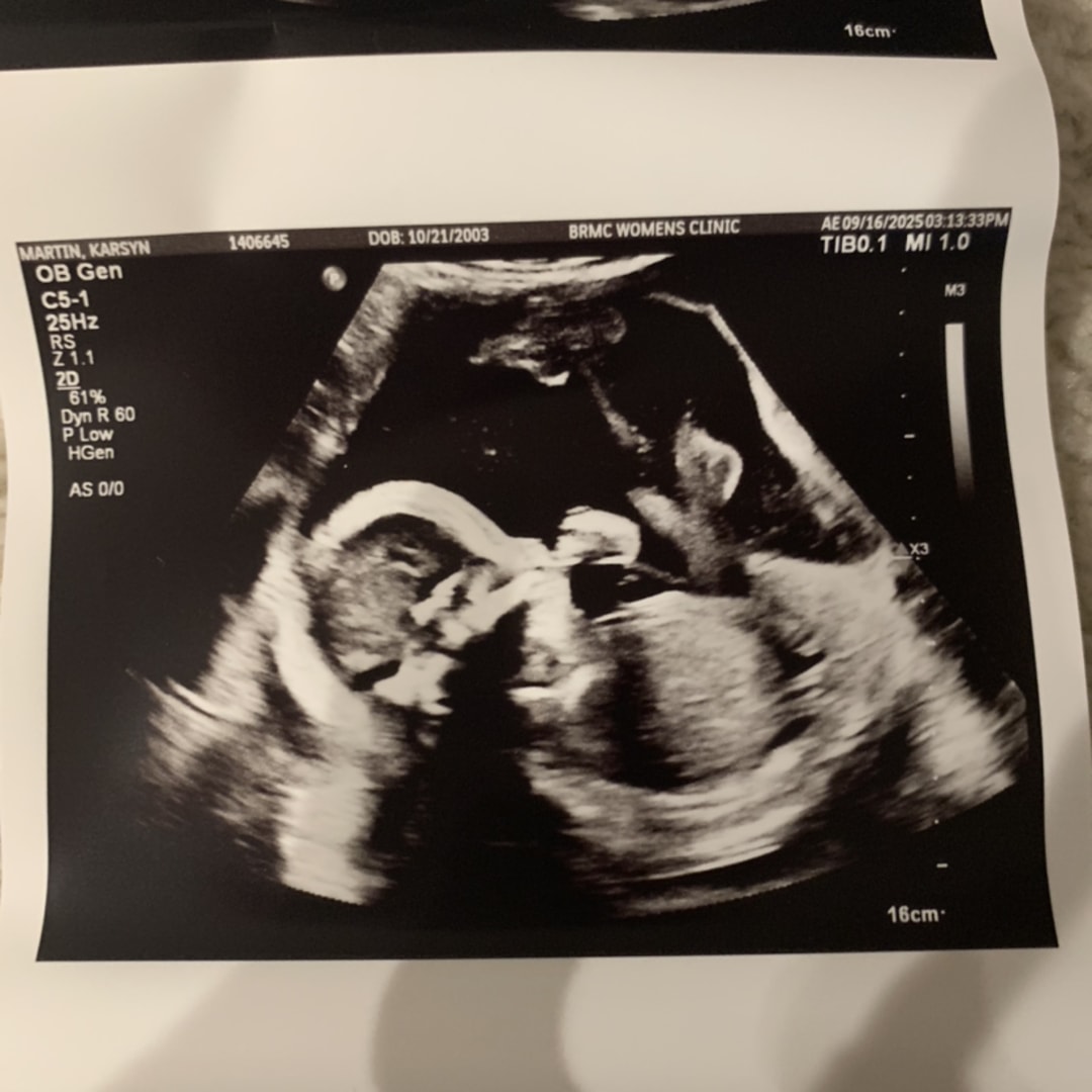 Photo shared by Karsyn for their Babylist baby registry.