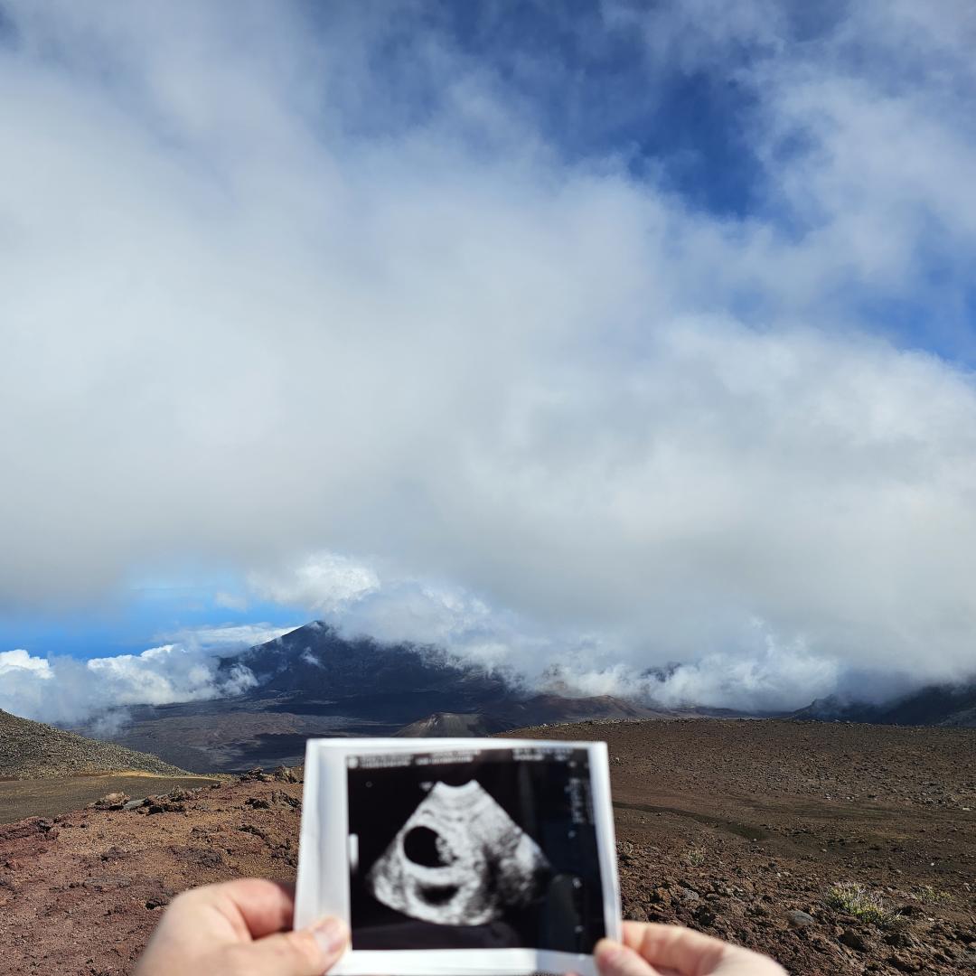 Photo shared by Karalyn for their Babylist baby registry.