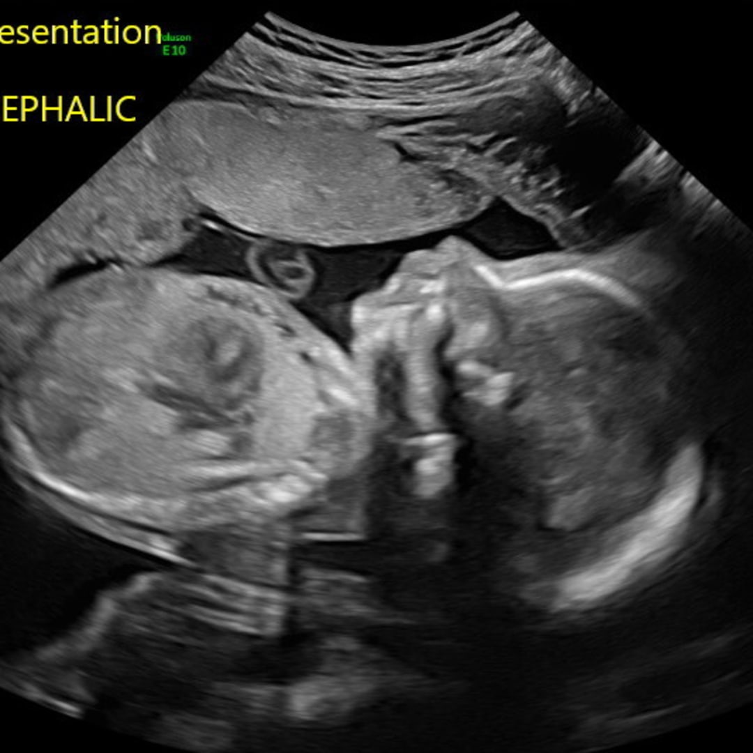 Photo shared by Journie for their Babylist baby registry.