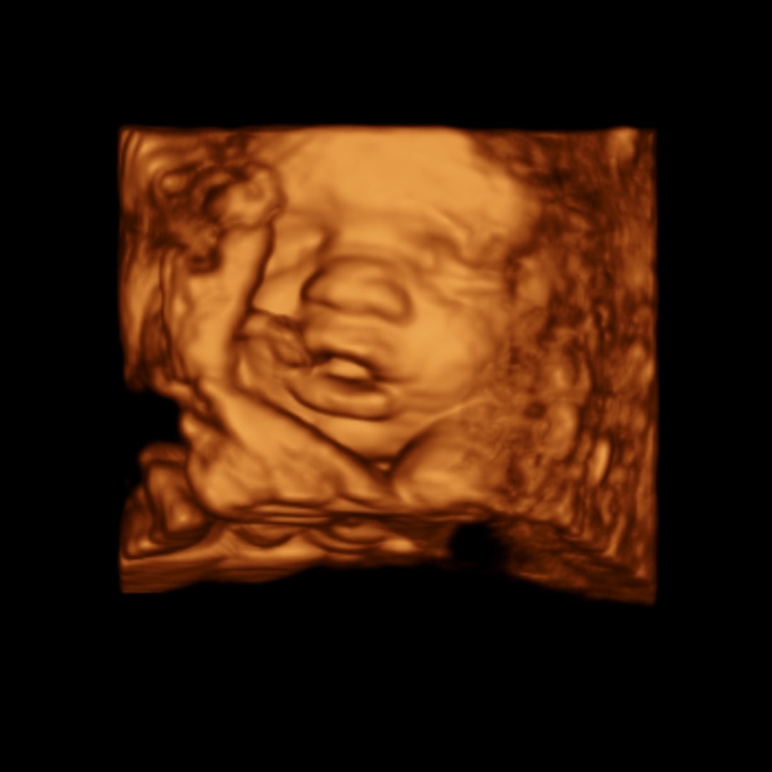 Photo shared by Dawson for their Babylist baby registry.