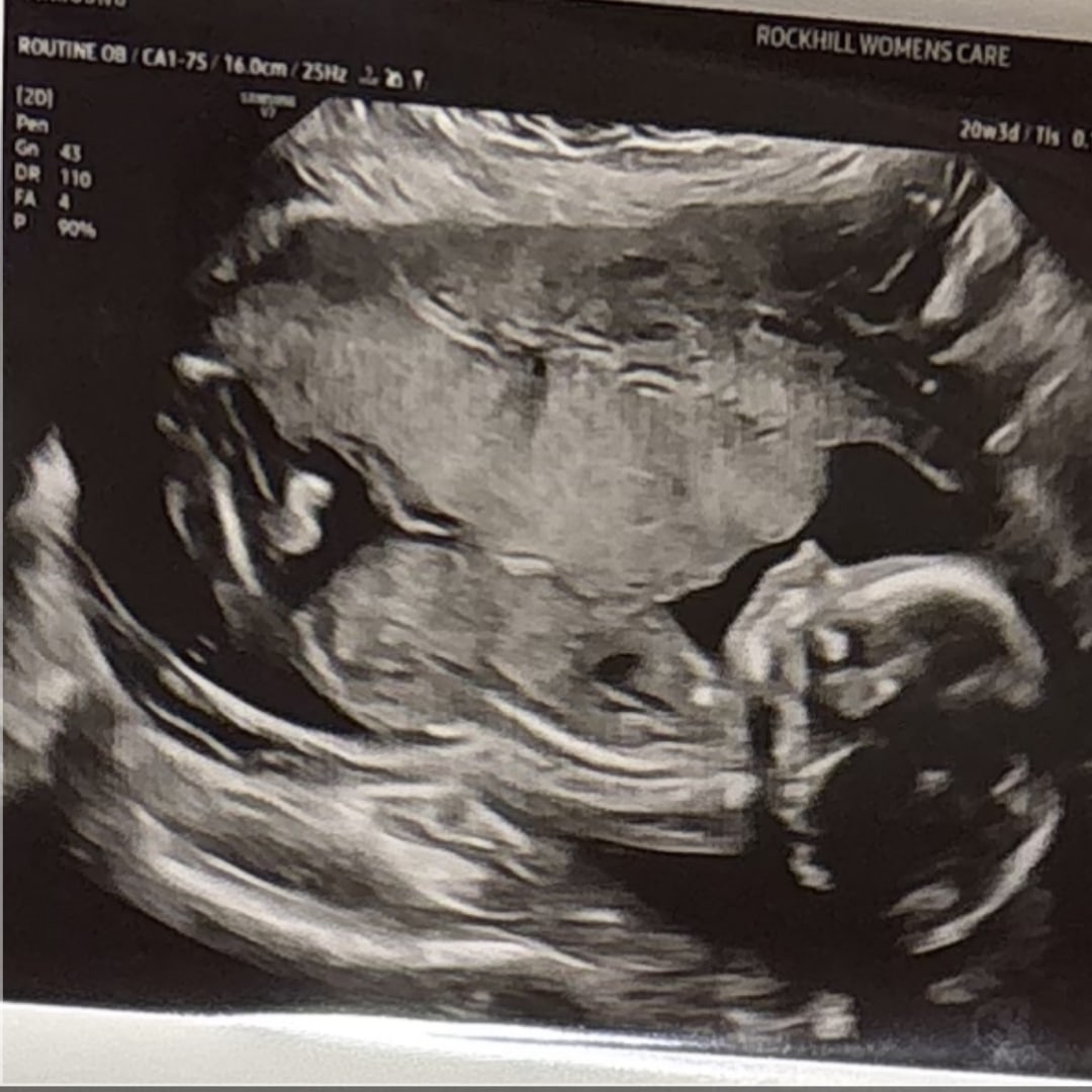 Photo shared by Makenzie for their Babylist baby registry.