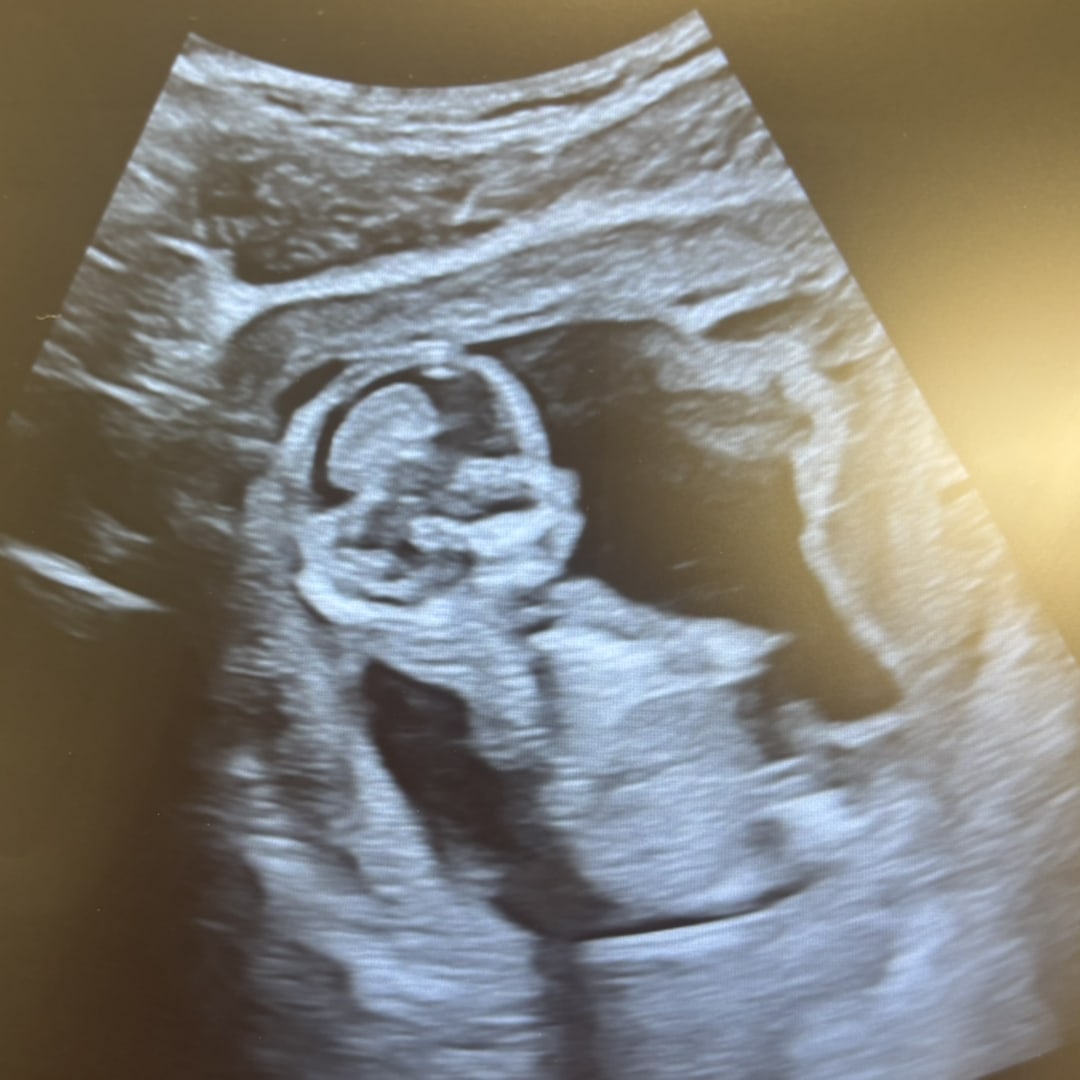 Photo shared by Teagan for their Babylist baby registry.