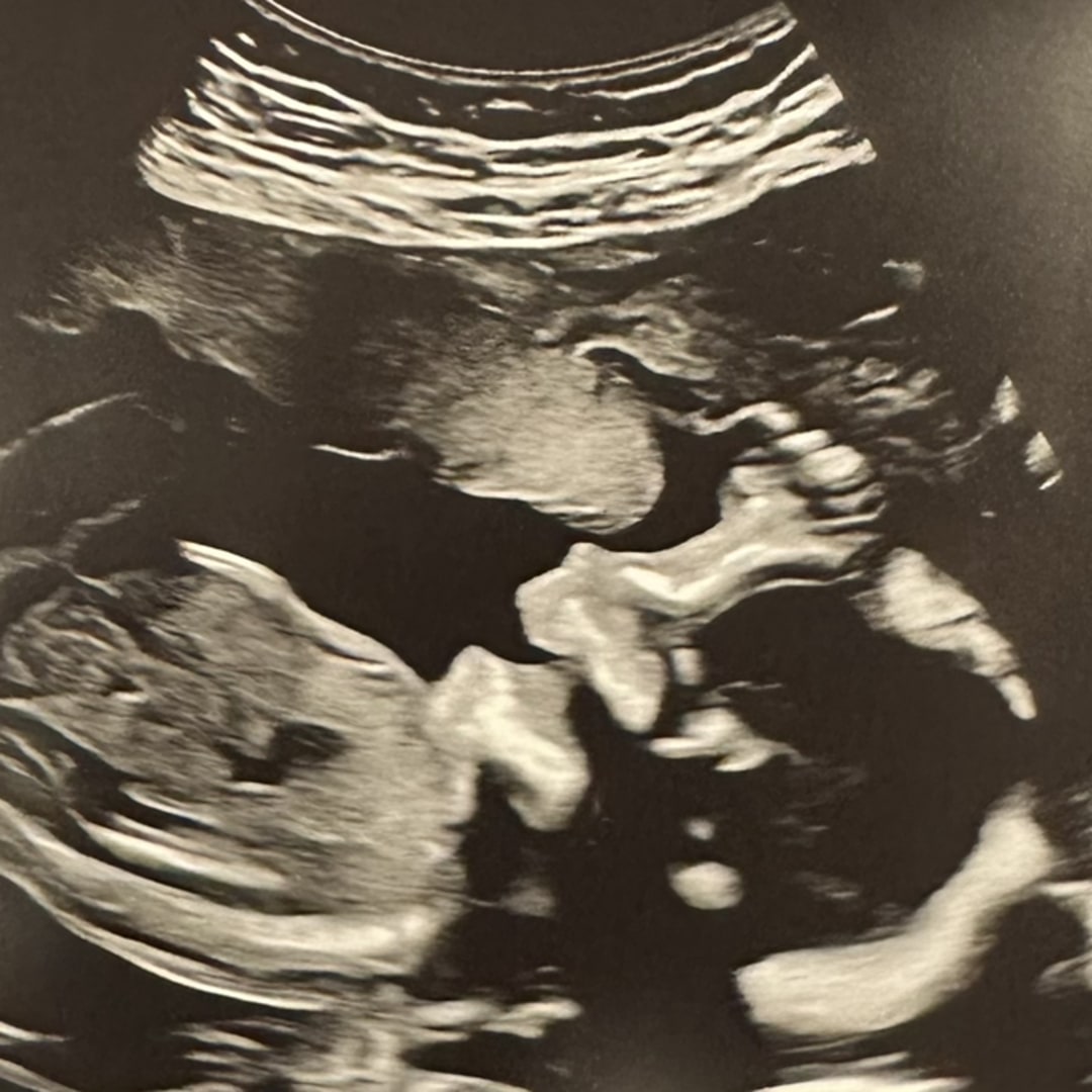 Photo shared by Monique for their Babylist baby registry.