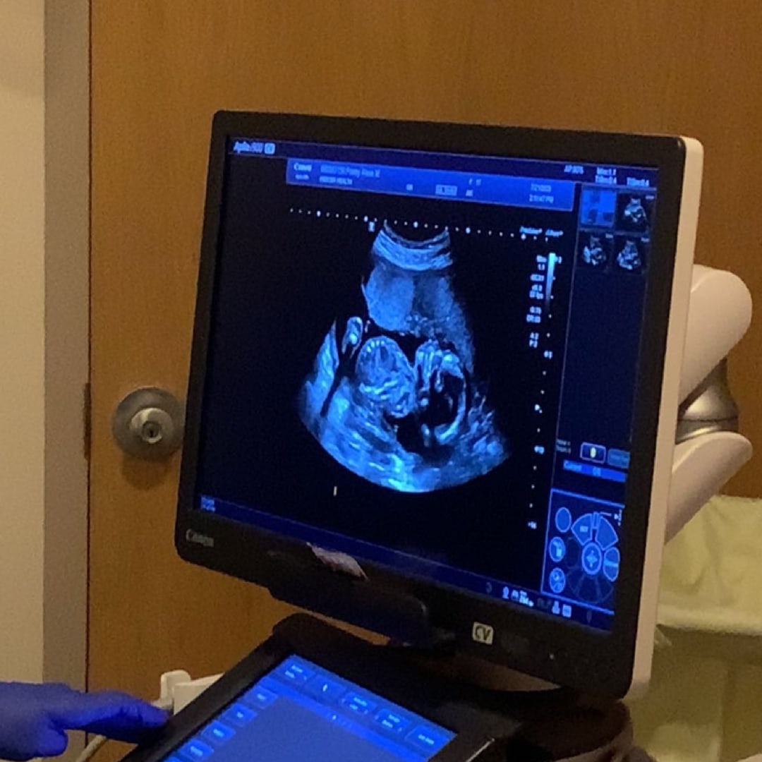 Photo shared by Alexa for their Babylist baby registry.