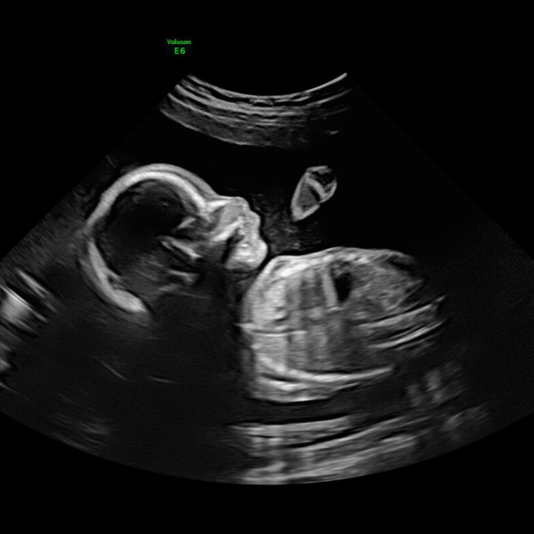 Photo shared by Eleni for their Babylist baby registry.