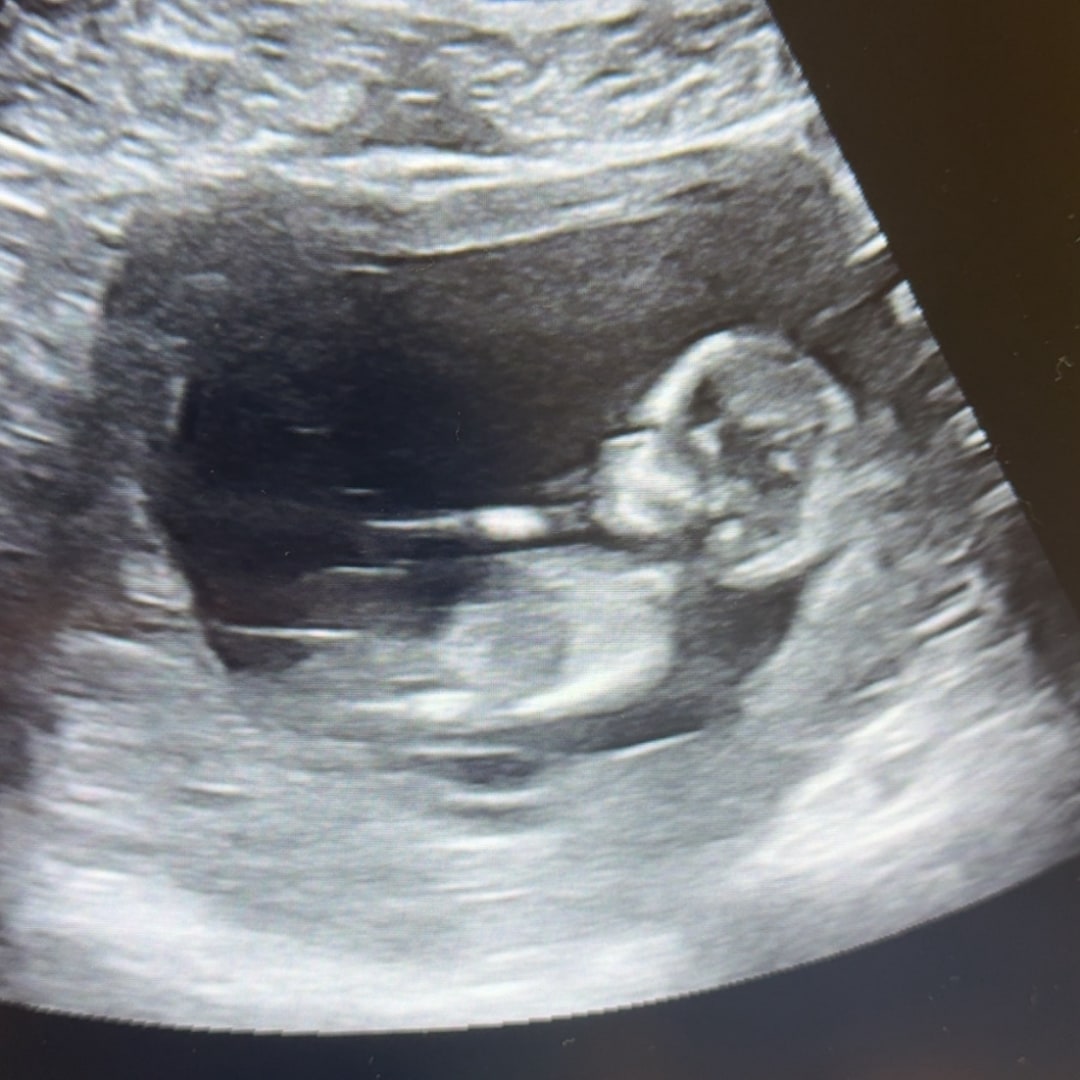 Photo shared by Brittany for their Babylist baby registry.