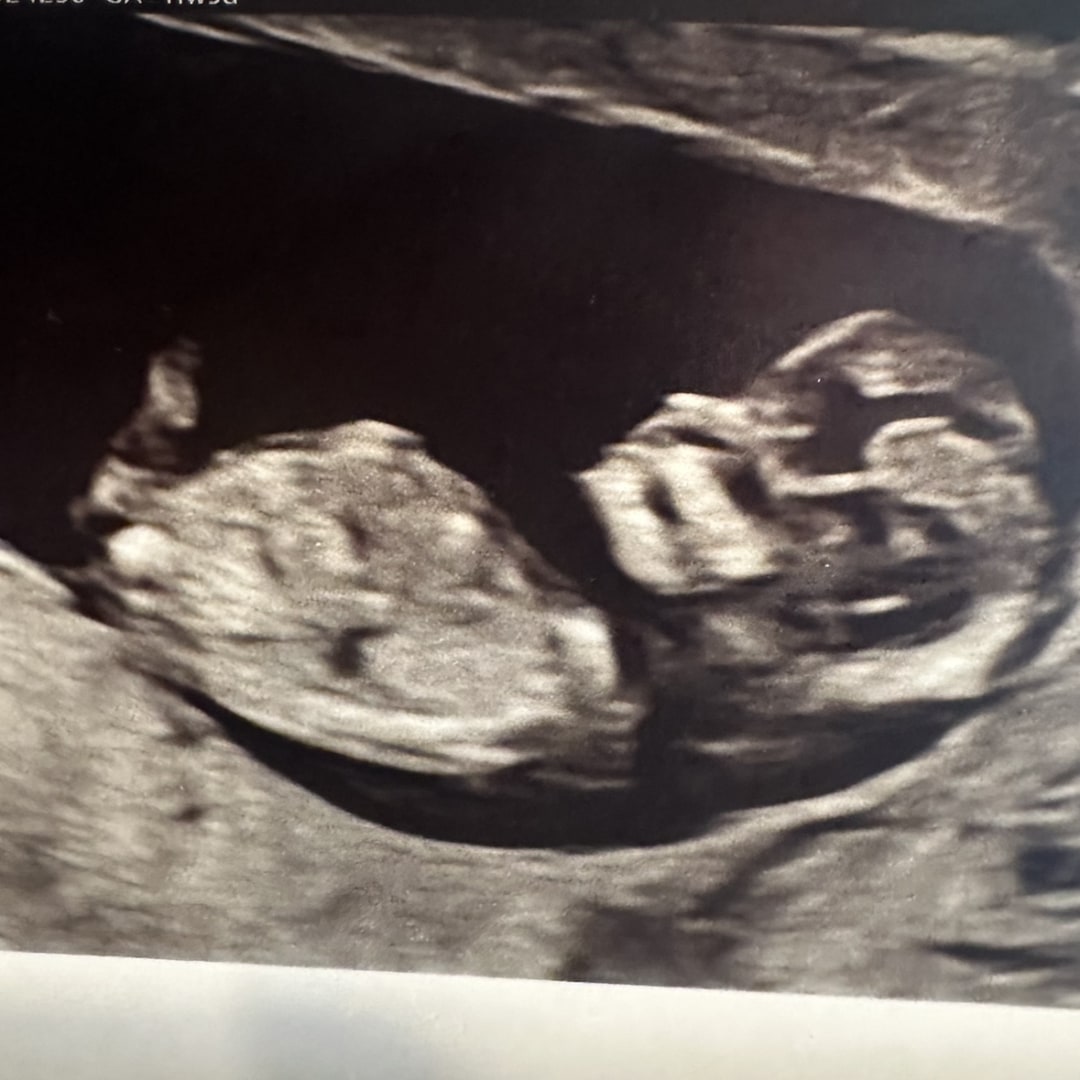 Photo shared by Emmie for their Babylist baby registry.