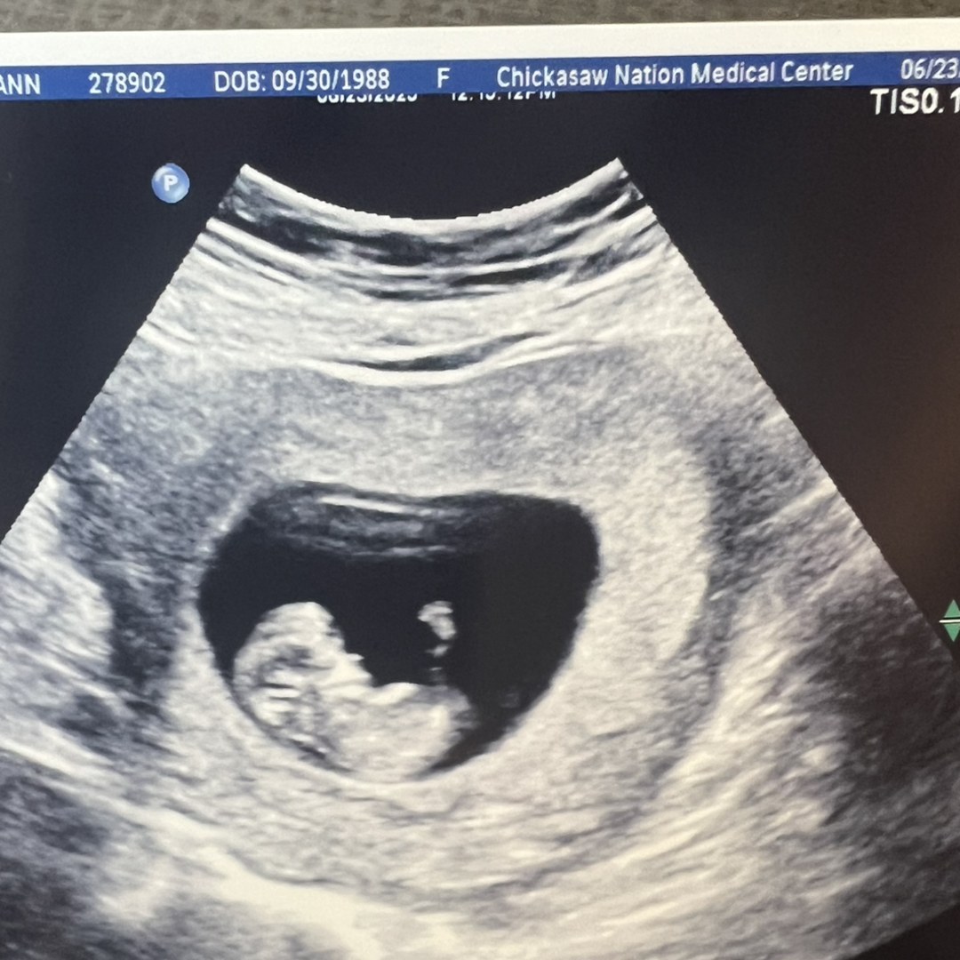 Photo shared by Alicia for their Babylist baby registry.