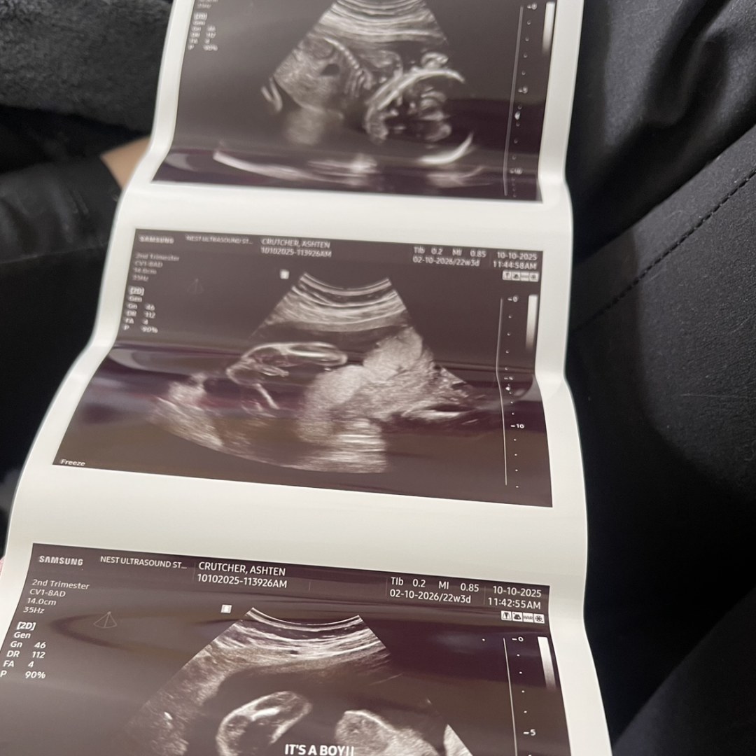 Photo shared by Ashten for their Babylist baby registry.