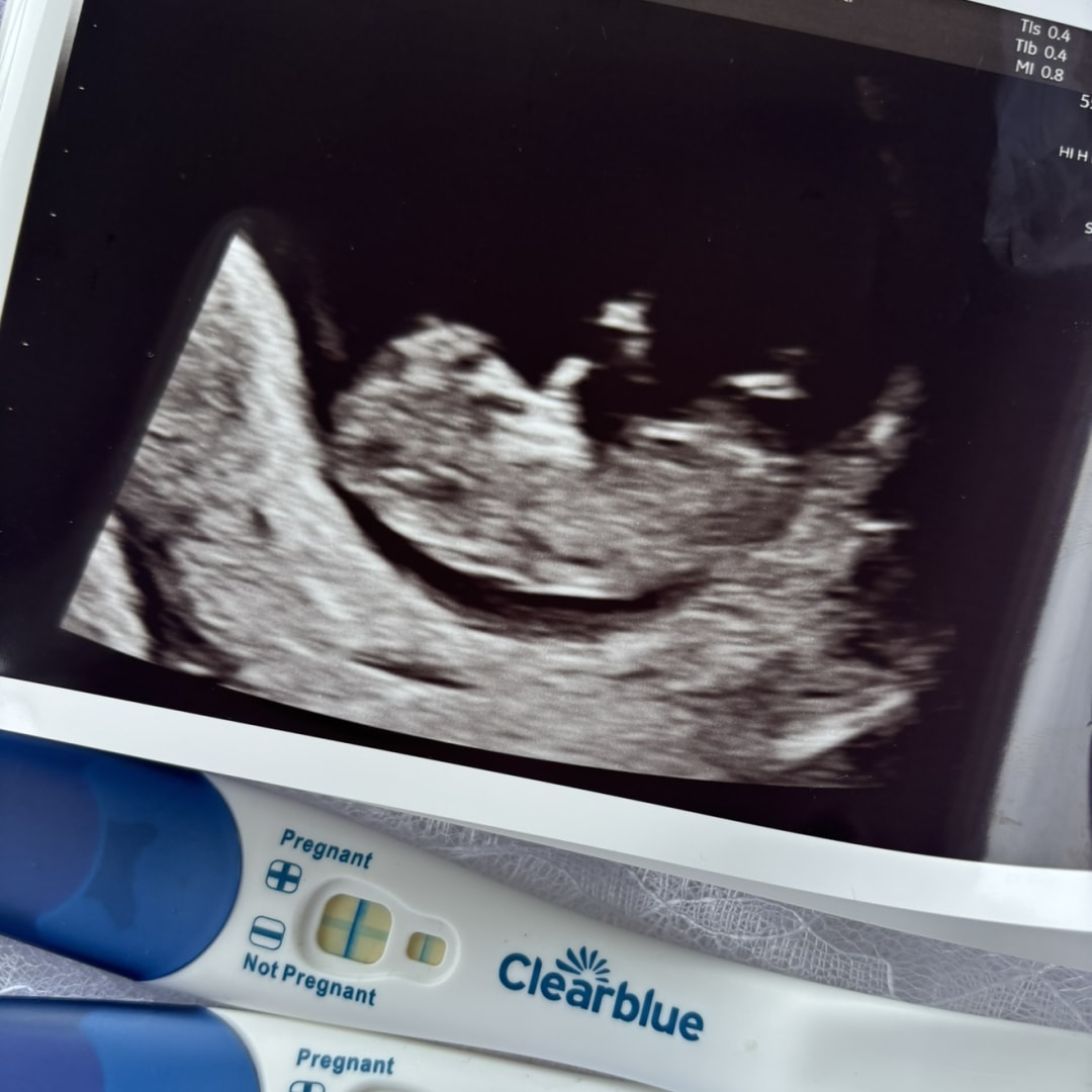 Photo shared by Jasmine for their Babylist baby registry.