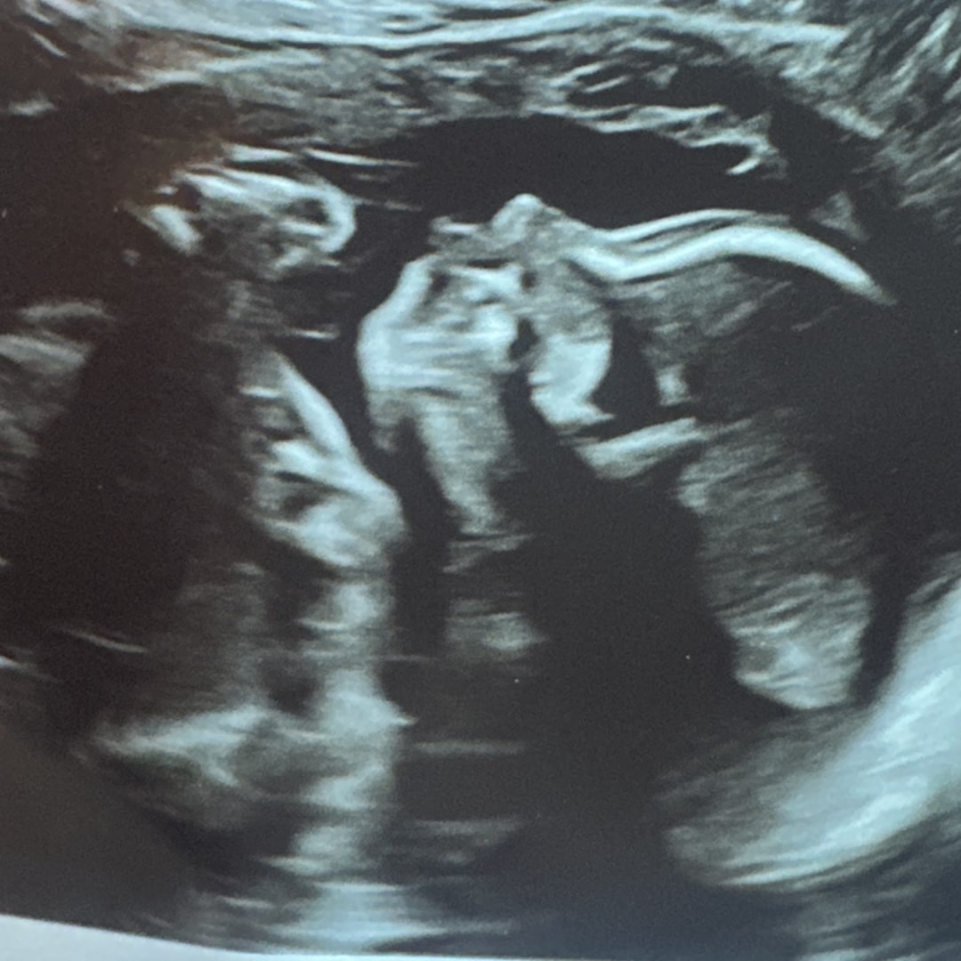 Photo shared by Anne-Marie for their Babylist baby registry.