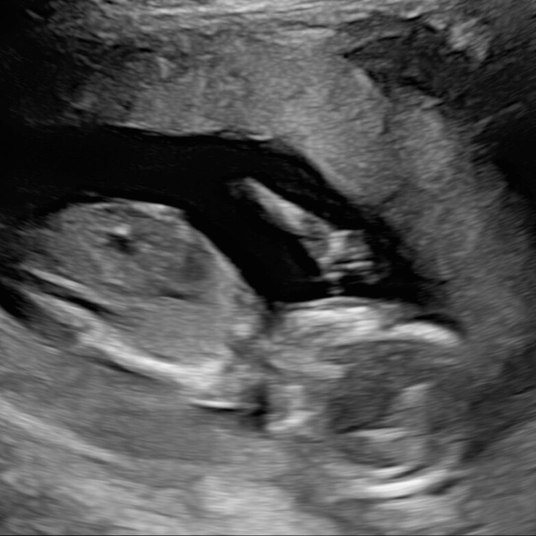 Photo shared by Emily for their Babylist baby registry.