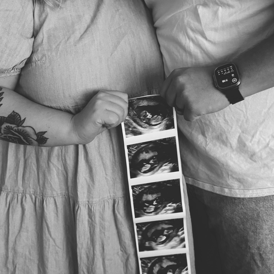 Photo shared by Kiley for their Babylist baby registry.