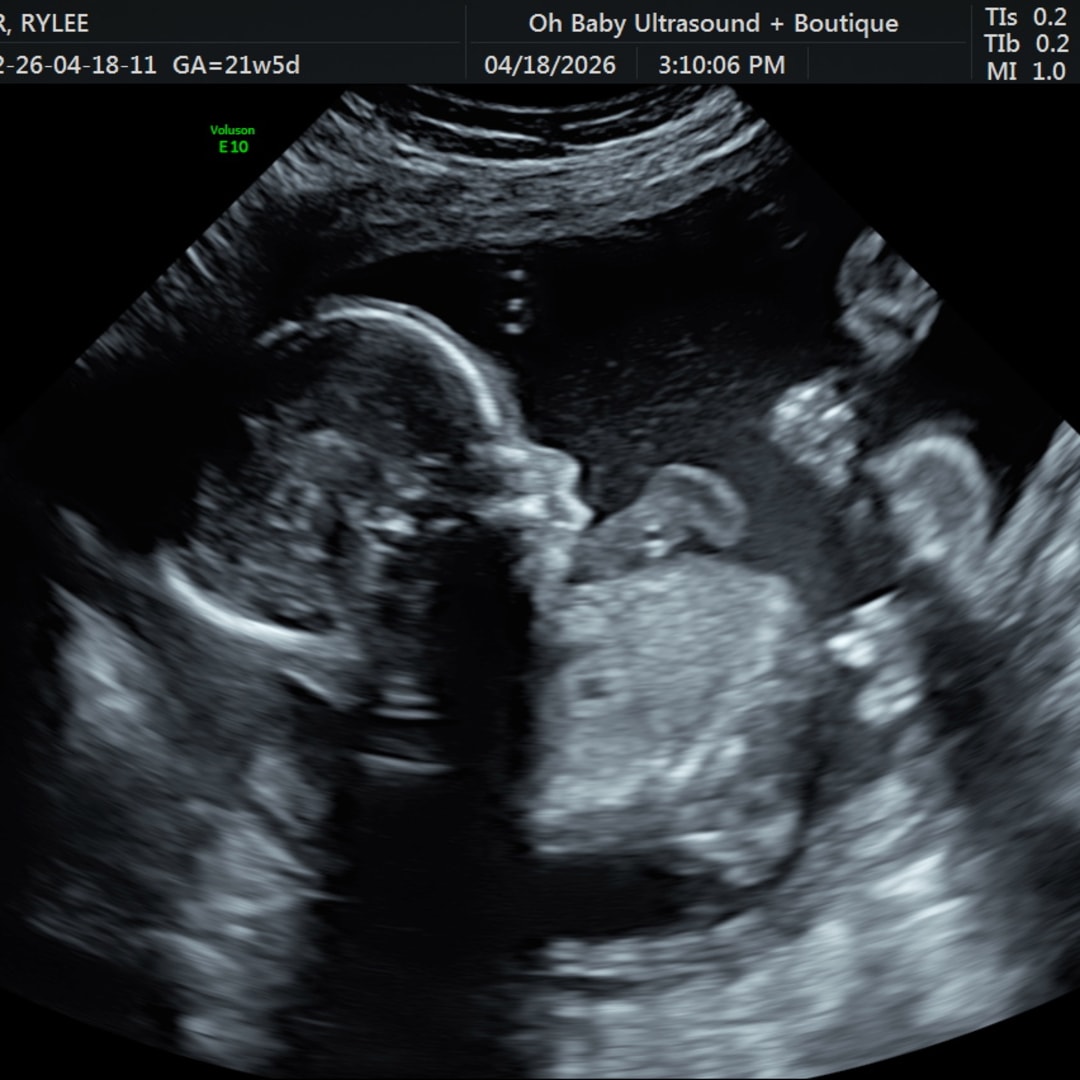Photo shared by Rylee for their Babylist baby registry.