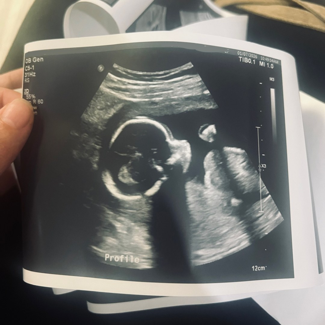 Photo shared by Jessie for their Babylist baby registry.