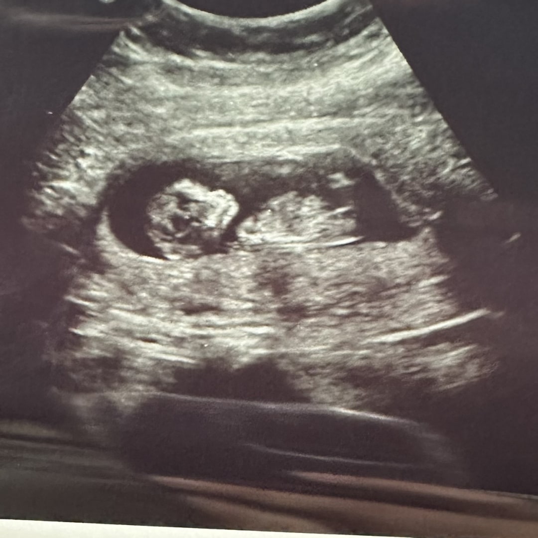 Photo shared by Roxanne for their Babylist baby registry.