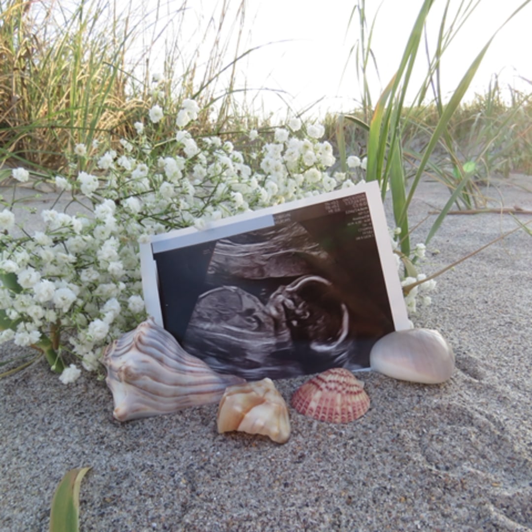 Photo shared by Amanda for their Babylist baby registry.