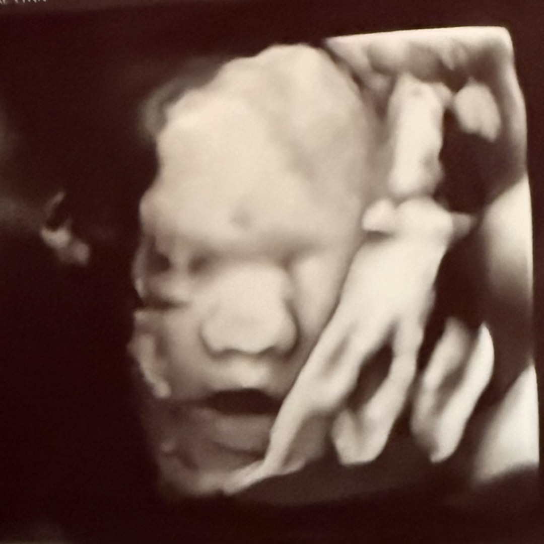Photo shared by Brooke-Lynn for their Babylist baby registry.