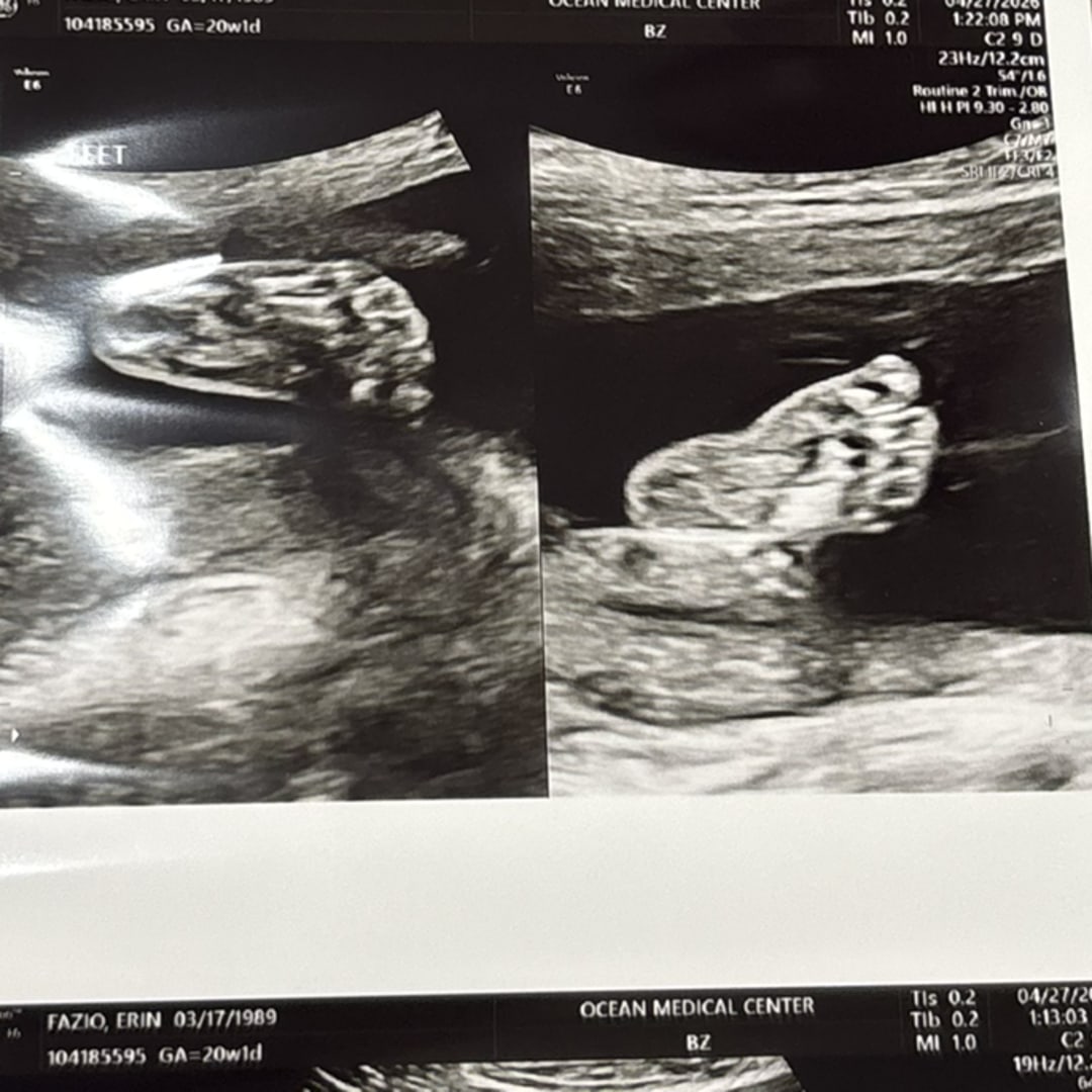 Photo shared by Erin for their Babylist baby registry.