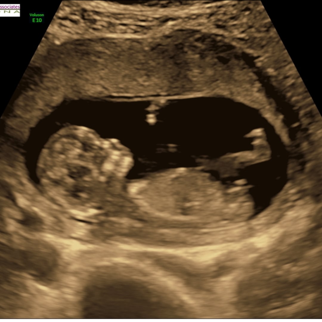 Photo shared by Lauren for their Babylist baby registry.