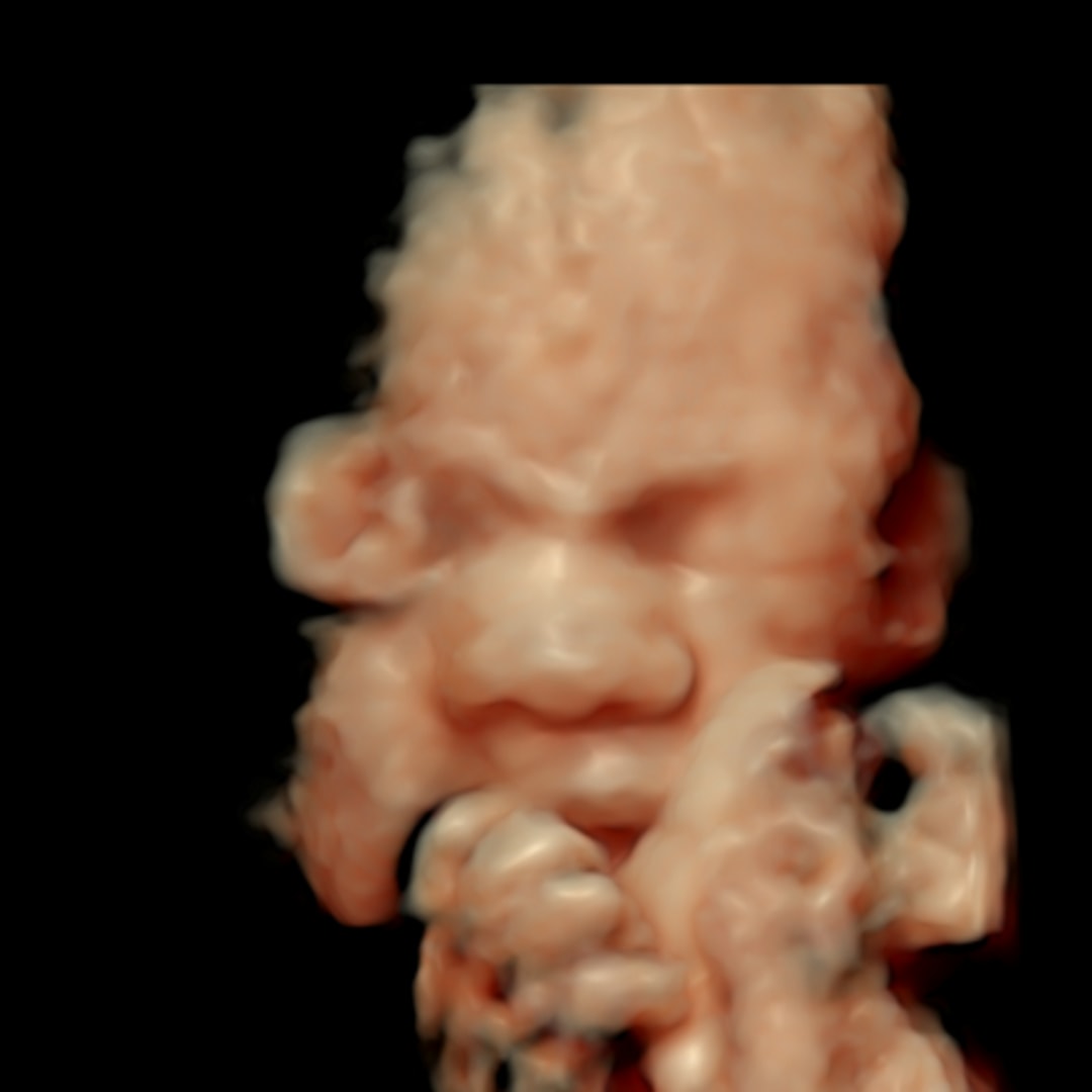 Photo shared by Laura for their Babylist baby registry.