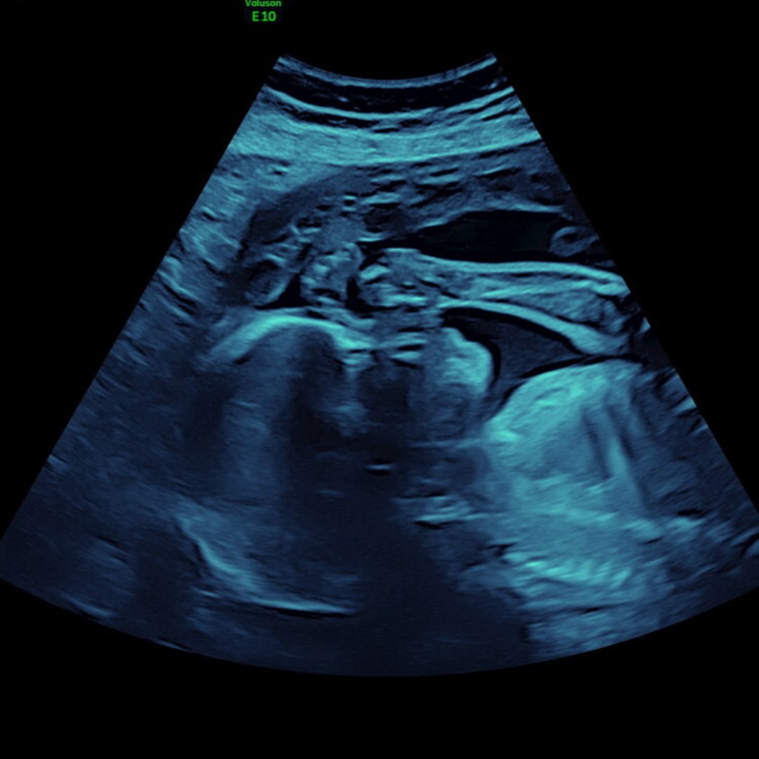 Photo shared by Travis for their Babylist baby registry.
