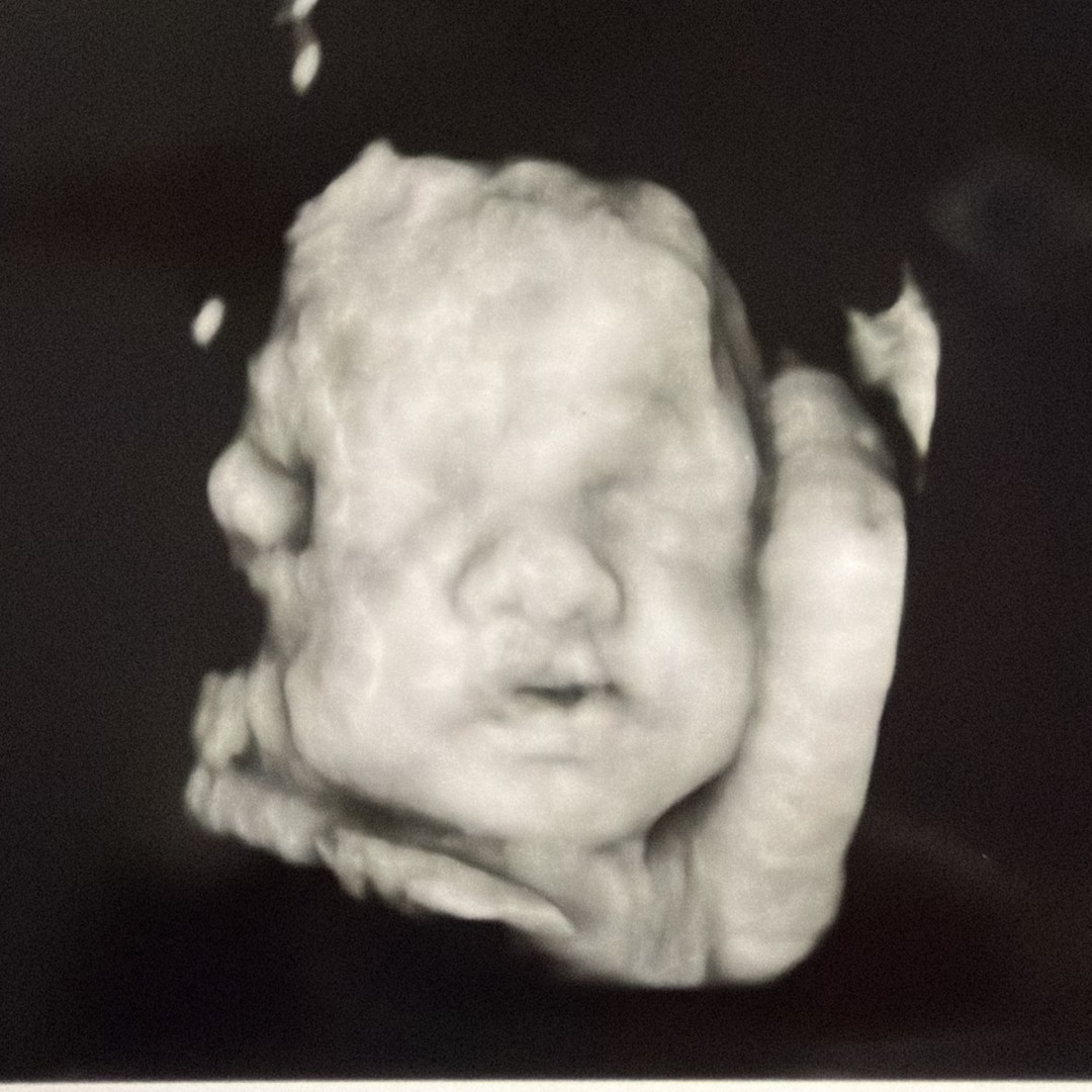Photo shared by Khya for their Babylist baby registry.